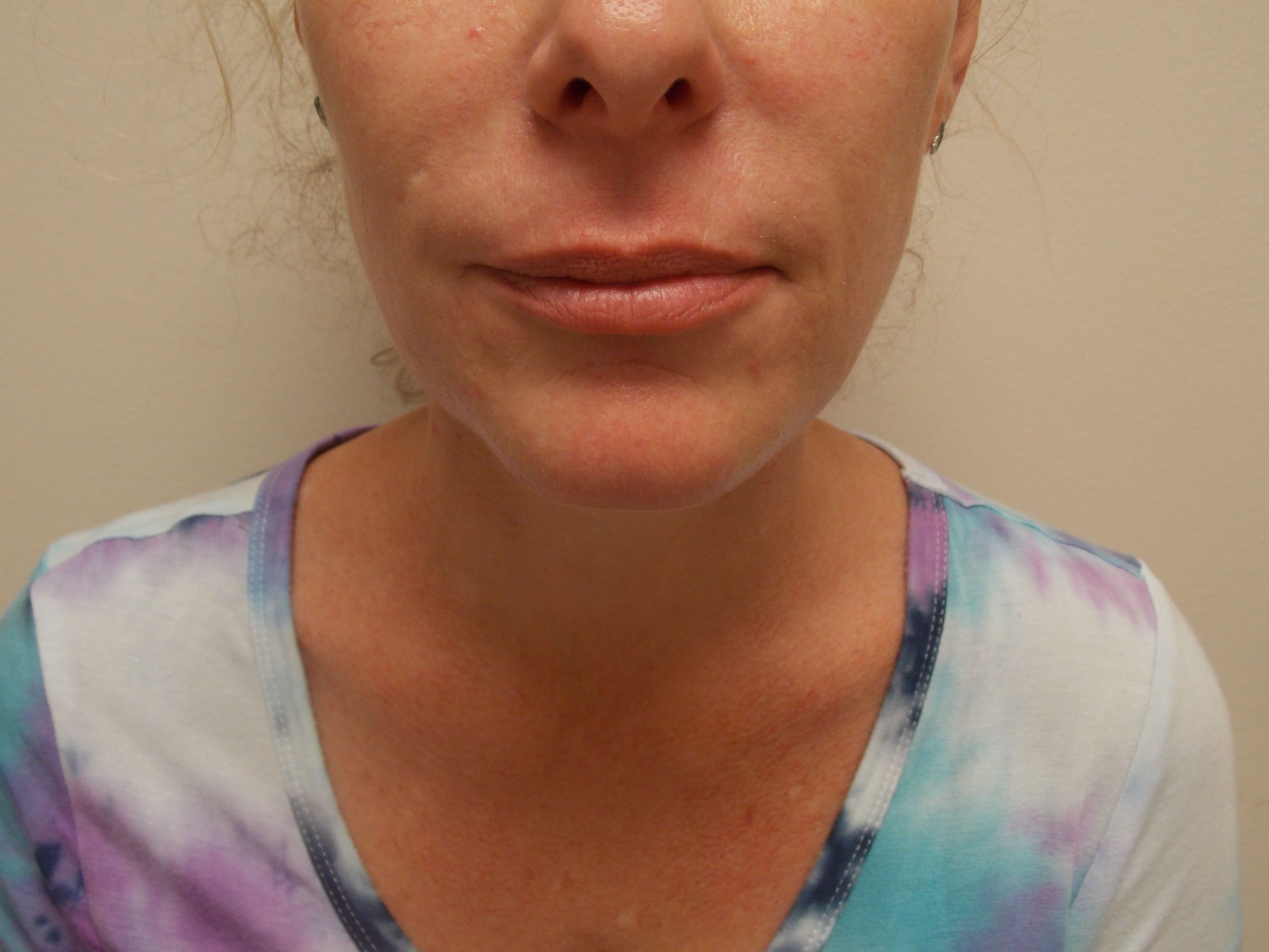 Before Image