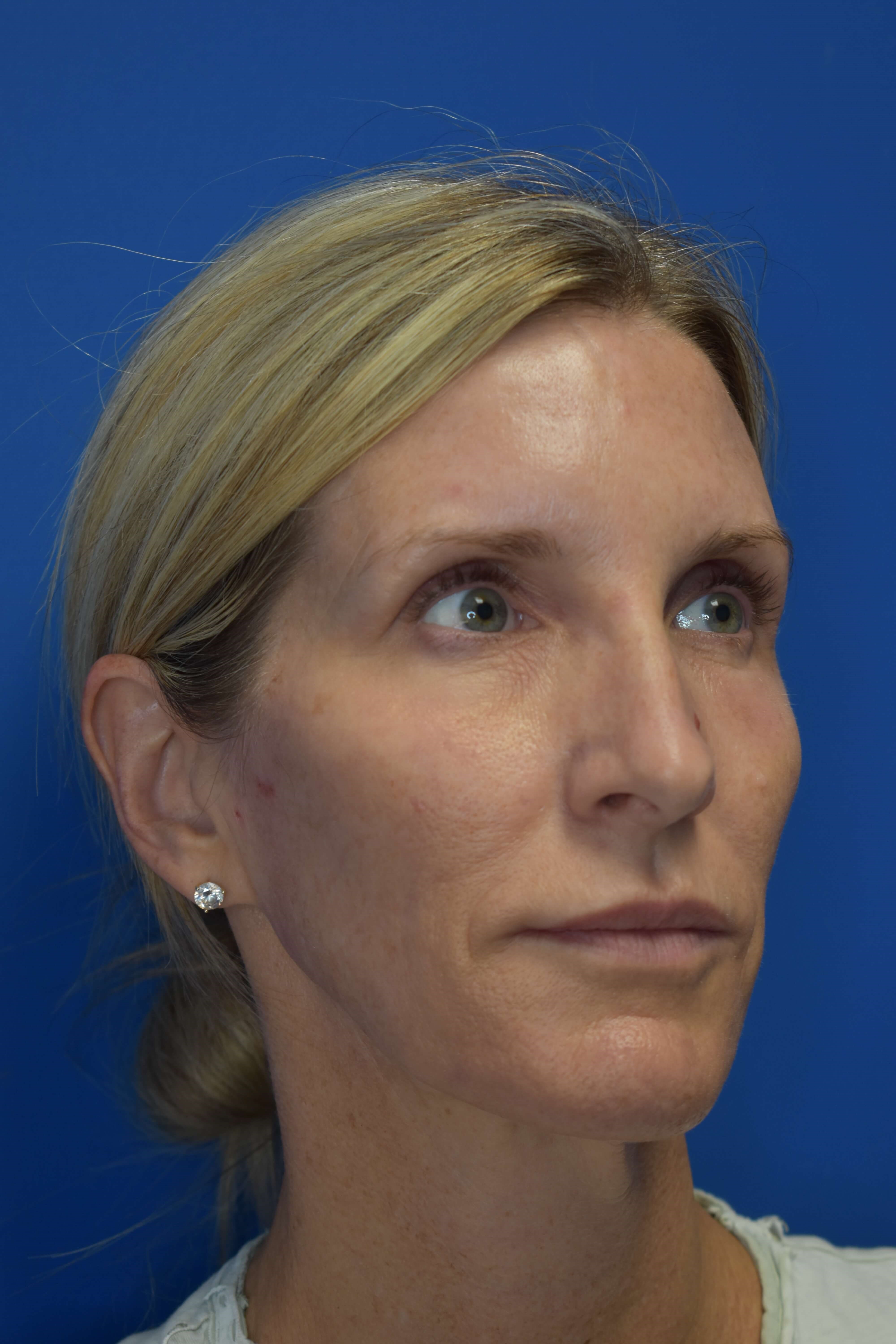 After Image