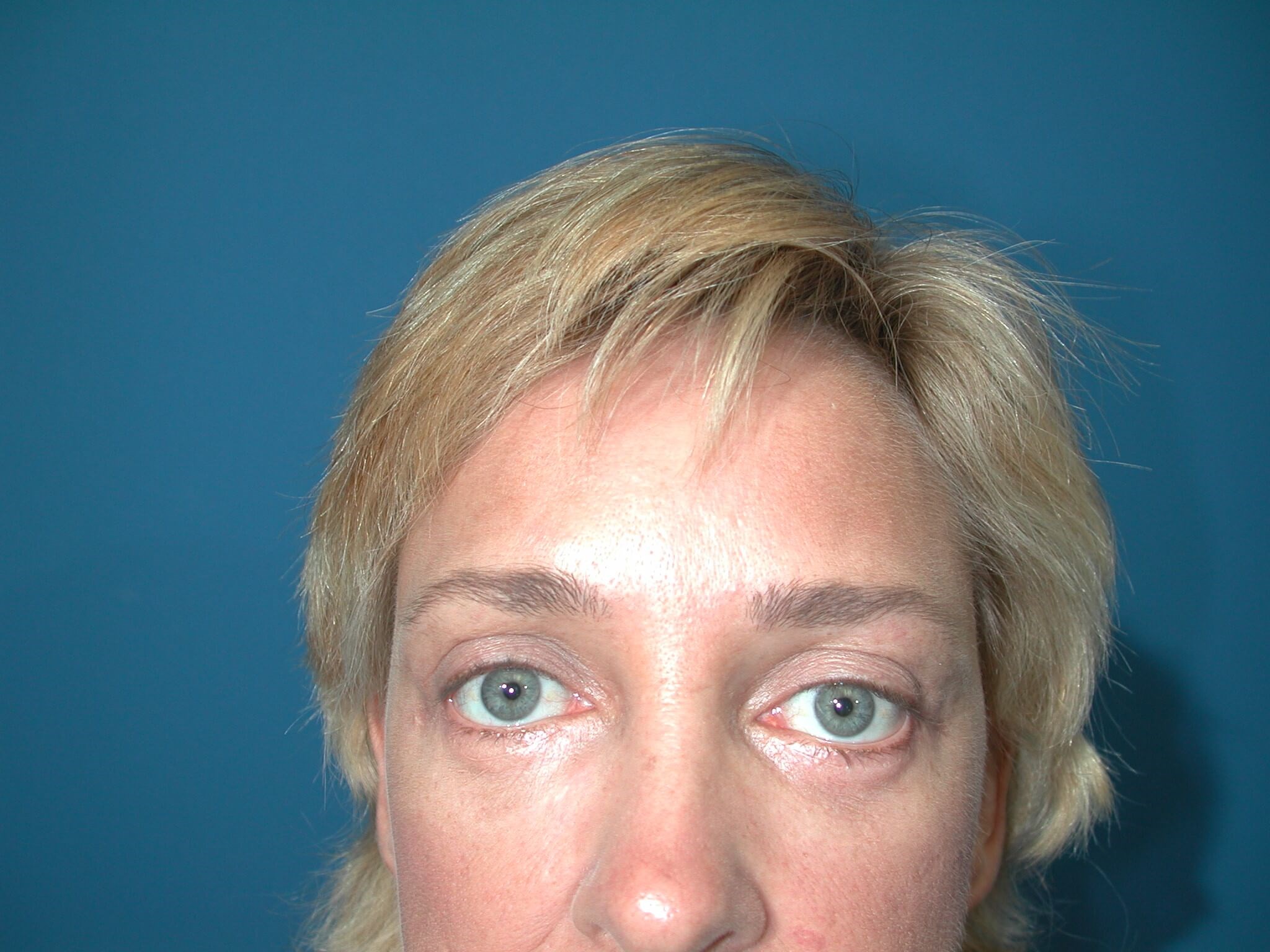 After Image