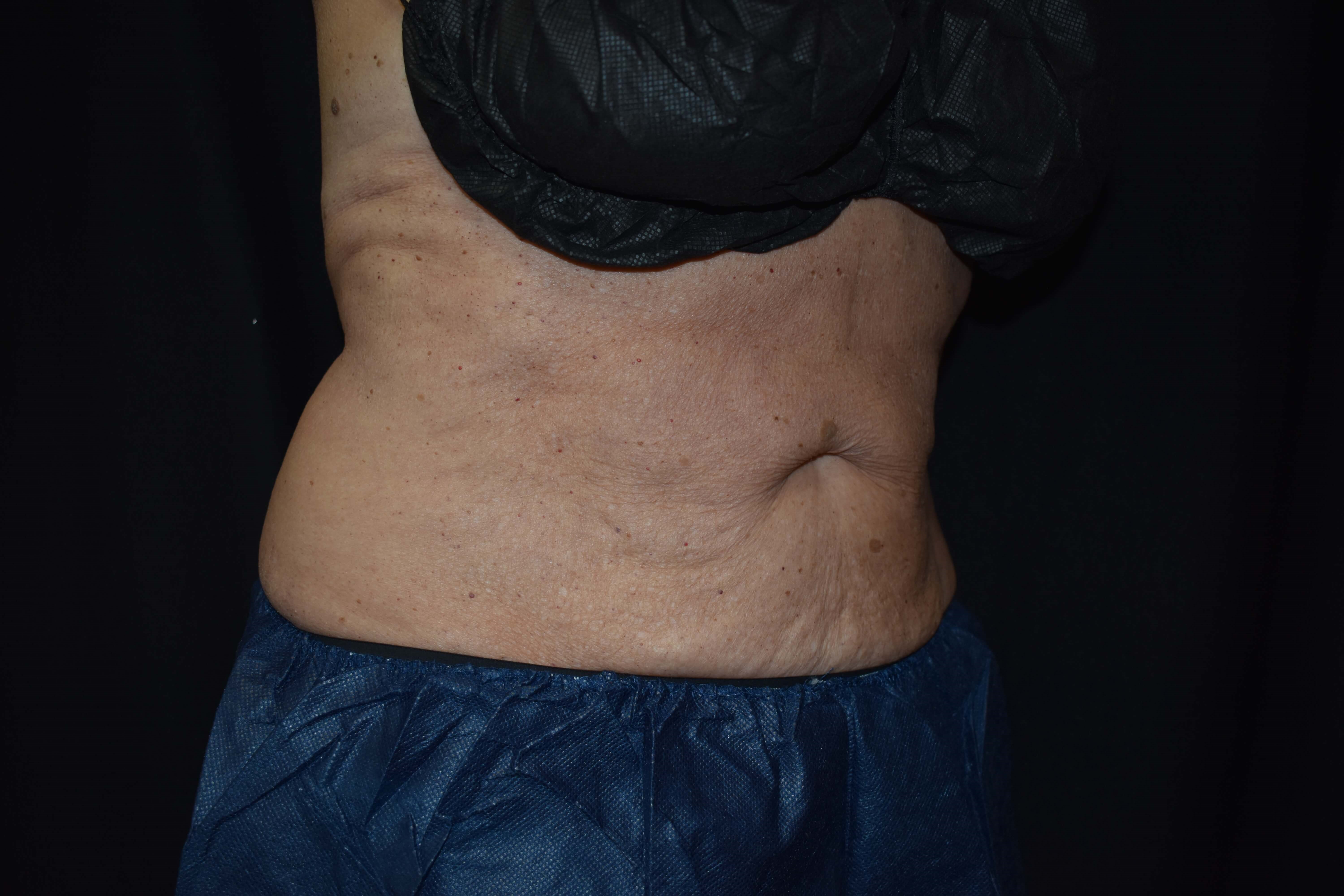 After Image