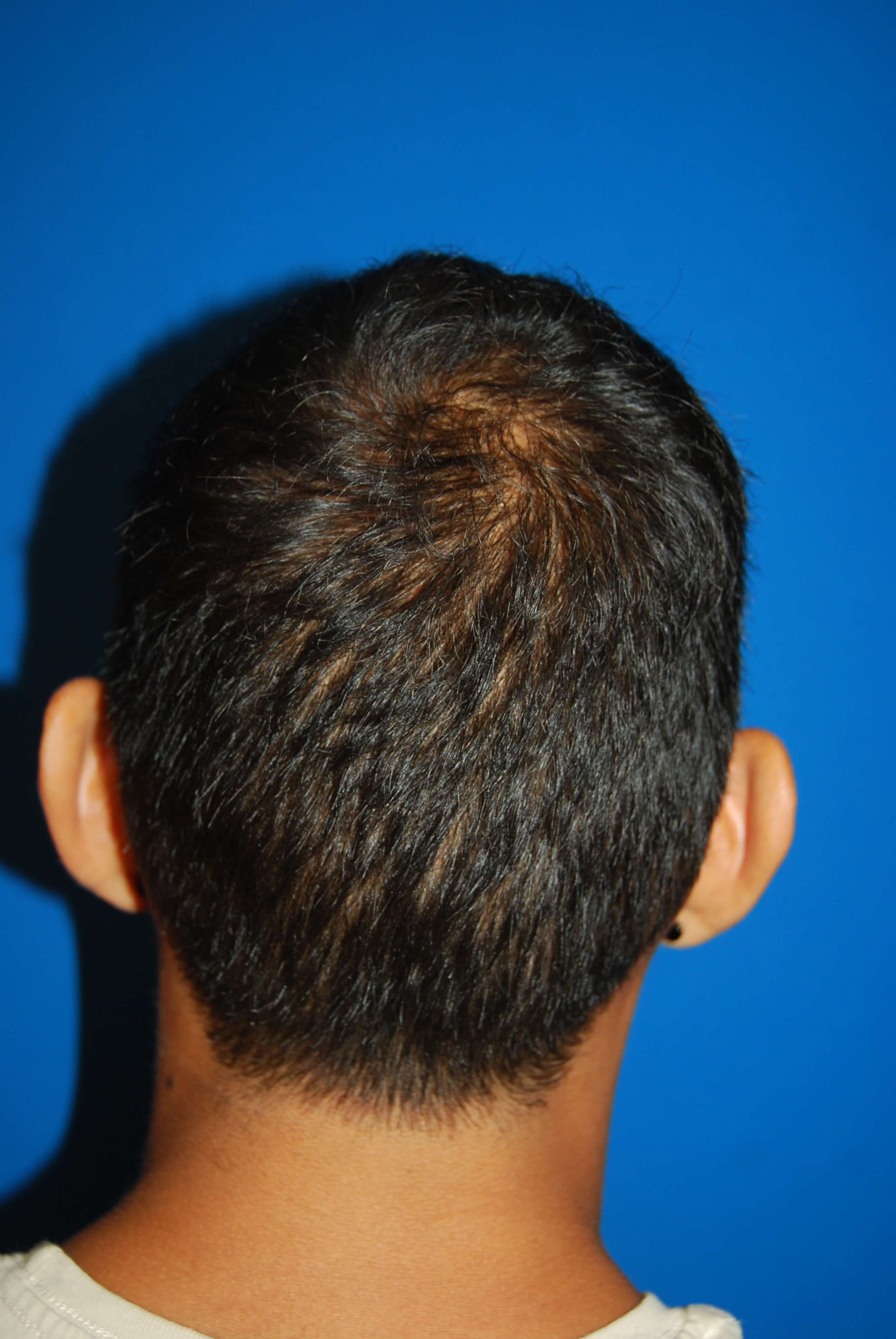 Before Image