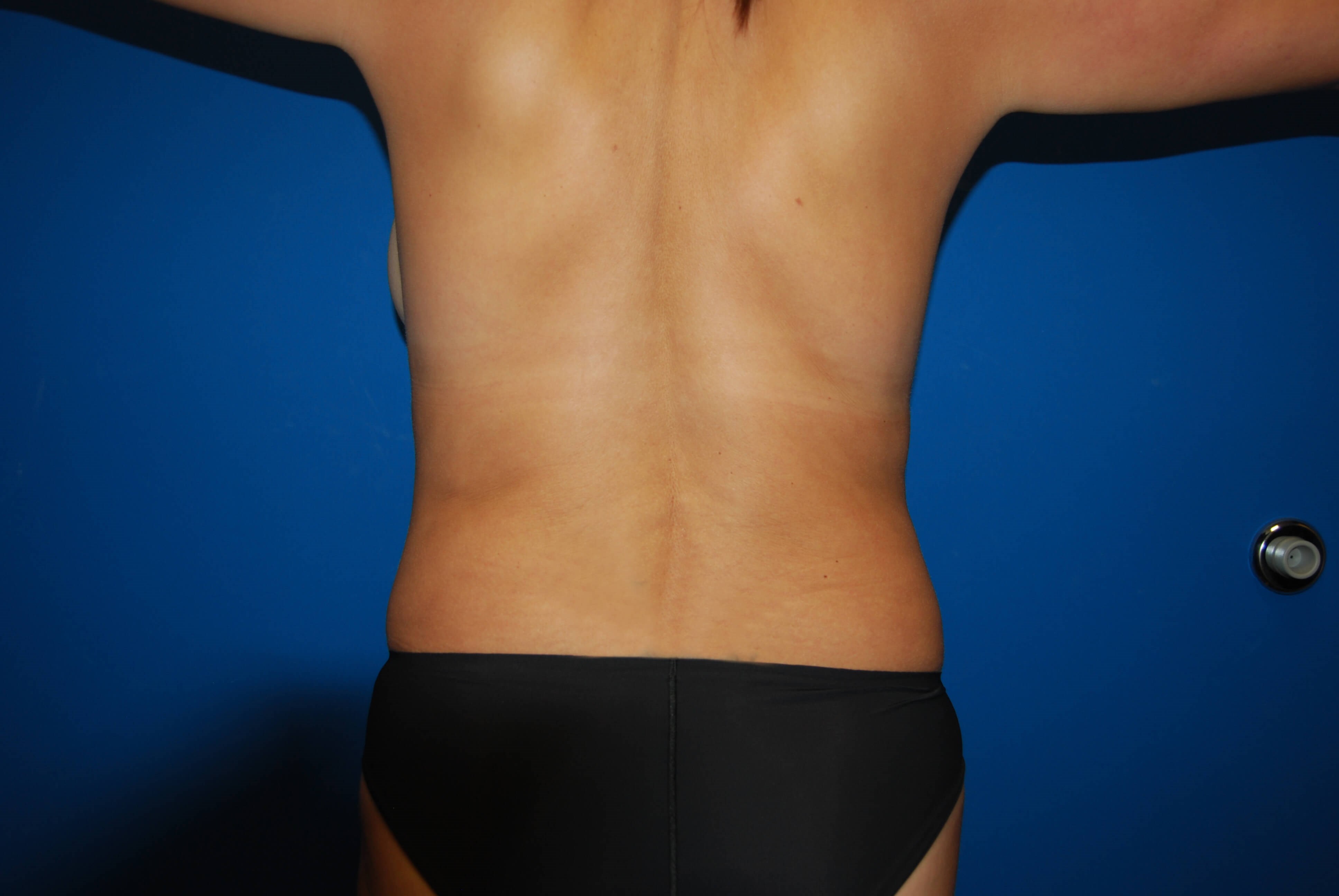 Back After